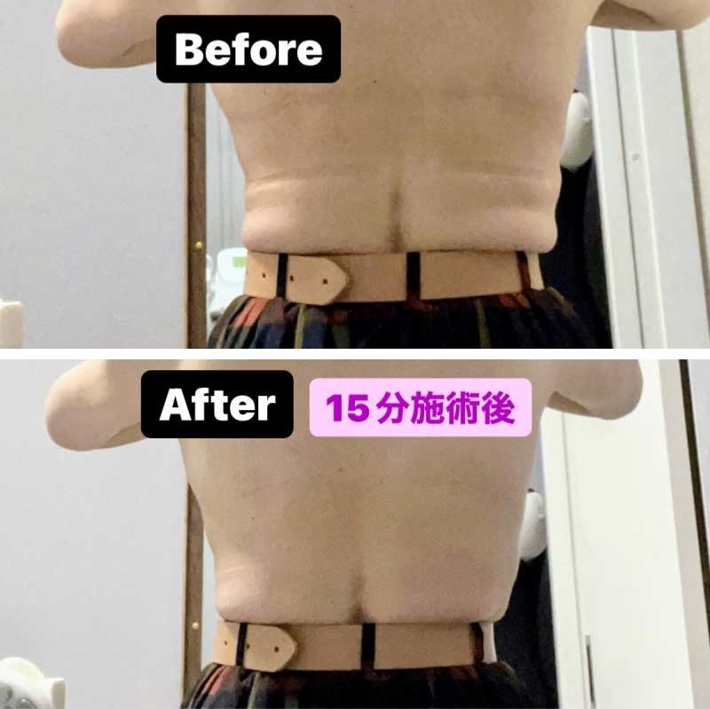 鴻巣の痩身エステのビフォー写真